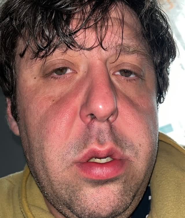 WORLD RENOWNED ALCOHOLIC-OBESE-TEENAGE-POP SENSATION FROM MANCHESTER, JIM E. BROWN WILL ATTEMPT TO DRINK ALL OF OUR BEER ON SEPTEMBER 21st.